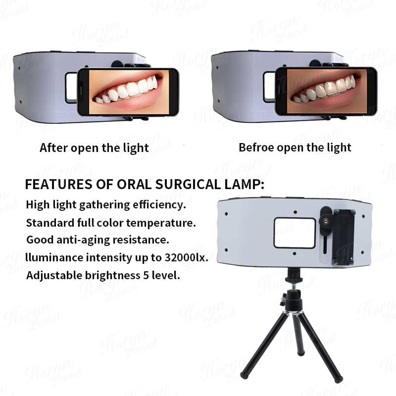 Luz de Flash Dental, equipo de - Photography Lighting With Flash reseña y precio
